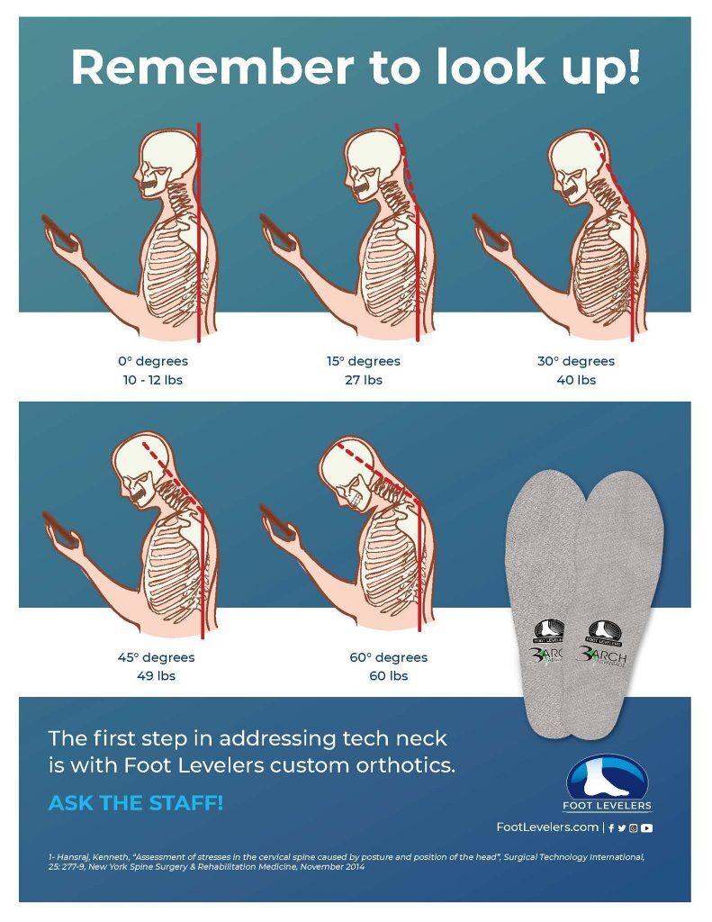 Forward Head Posture and Neck Pain (Cervical Kyphosis) - Foot Levelers